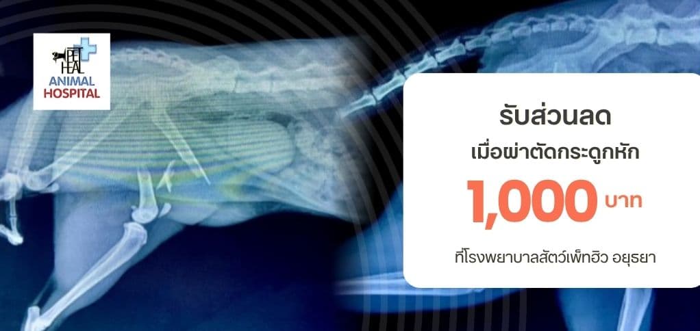 ลด 1,000 บาท สำหรับผ่าตัดกระดูกหัก